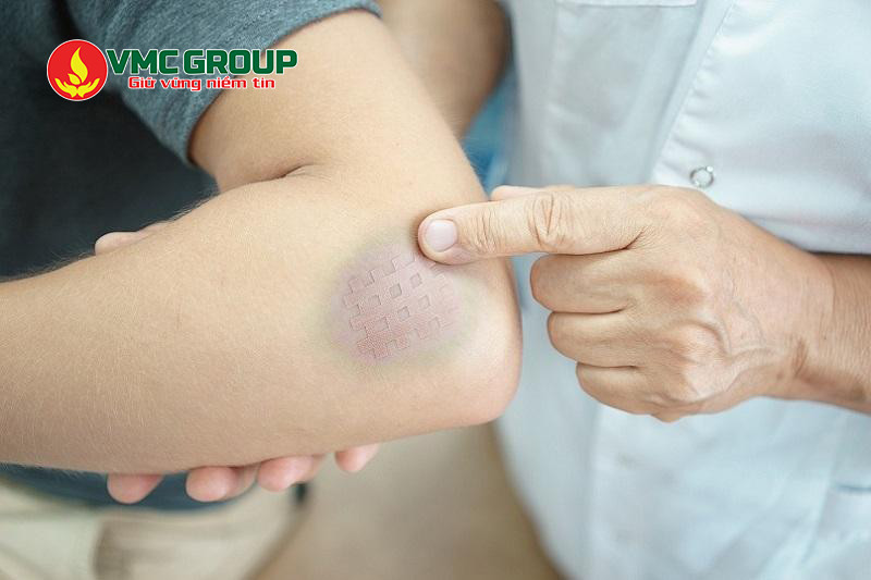 Bột long não được dùng nhiều trong chăm sóc sức khỏe